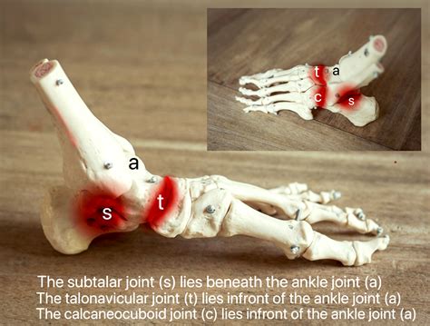 Triple & Double Ankle Fusions | Foot Joint Fusions | David Redfern