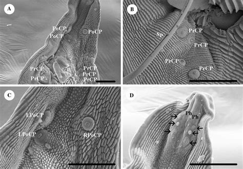 Scanning Electron Micrographs Of Habronema Muscae A Posterior