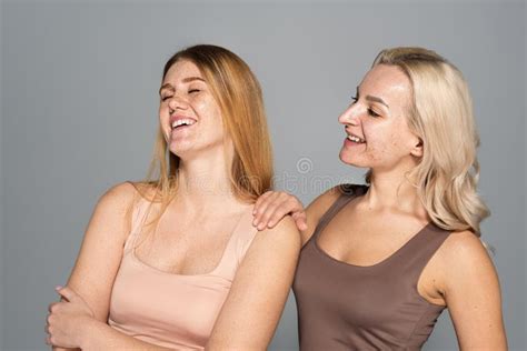 Positive Blonde Woman With Acne Standing Stock Photo Image Of Attractive Caucasian