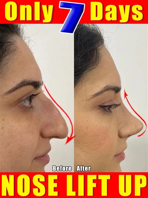 Nose Lift Up Essential Oil Beautiful Nose High