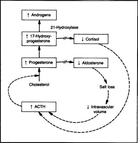 Congenital Adrenal Hyperplasia Due To 21 Hydroxylase Deficiency Nejm