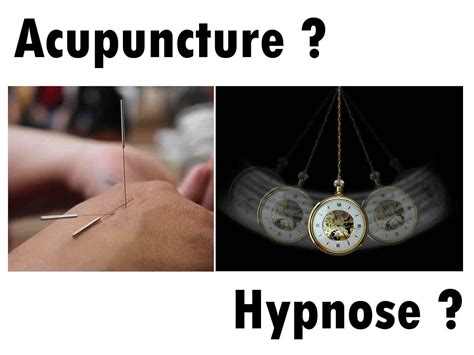 Acupuncture ou Hypnose pour Arrêter de Fumer Arrêt Tabac Hypnose