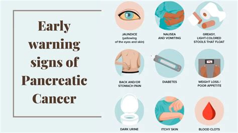 Early Warning Signs Of Pancreatic Cancer | Pancreatic Cancer Treatment