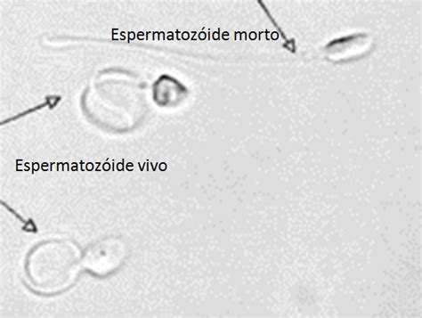 Testes De Vitalidade Nidus Medicina Reprodutiva