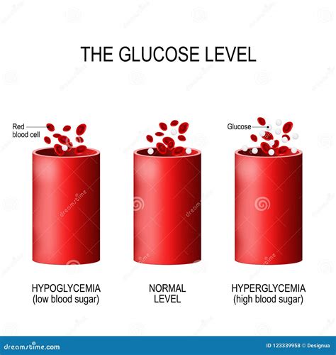 Hyperglycemia High Blood Sugar And Diabetes Obesity Is A Serious