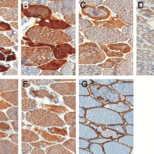 Immunohistochemical staining of Z-disk proteins performed on serial ...