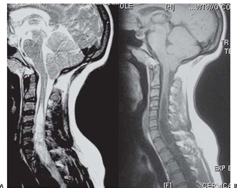 Pathology And Radiology Neupsy Key