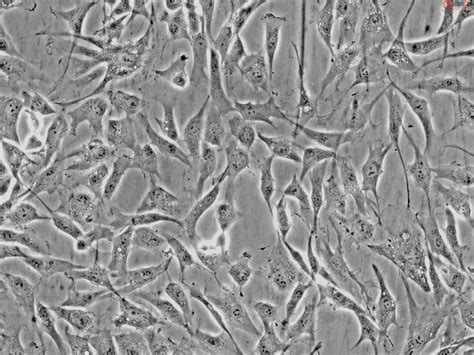 Fibroblasts Worlds Largest Provider Of Primary Cells Cell Culture