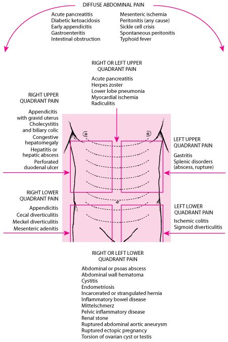 Stomach Pain Diagnosis Chart