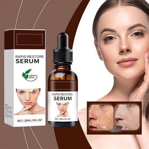 Melasma Fading And Nourishing Skin Care For Facial 30ml Smooth Skin