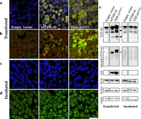 No Intercellular Propagation Of Tdp Pathology Is Detected In