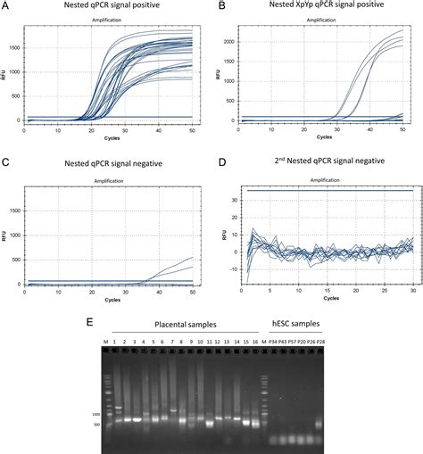 Telomere Fusions As A Signal Of Term Placental Aging A Pilot Study In