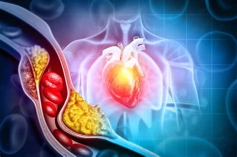 Nejlepší čaje na čištění cév a rozpouštění cholesterolu Většinu z nich