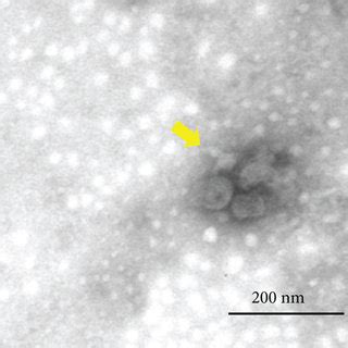 Identification Of Exosomes From Stem Cells Of The Apical Papilla