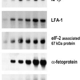 Northern Blot Analysis Of Genes Identified By Suppression Subtractive