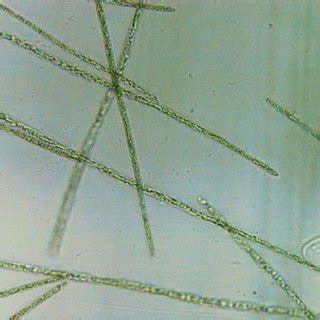 Aphanizomenon Flos Aquae Ralfs Ex Bornet Flahault Microscope Image