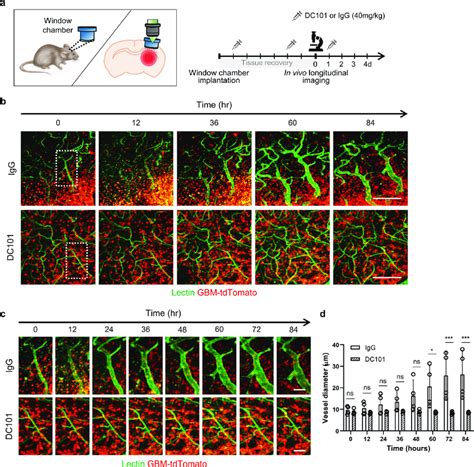 Progressive Vasodilation Associated With GBM Invasion Depends On VEGFR2