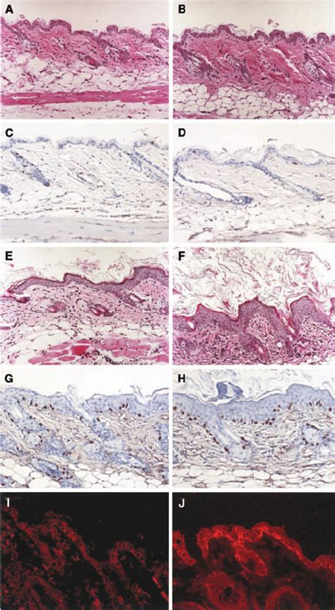 Histological Analysis Of TPA Induced Epidermal Hyperplasia In The