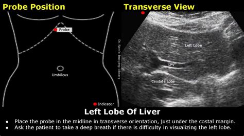 Abdominal Gynecological And Obstetric Ultrasound Probe Positioning