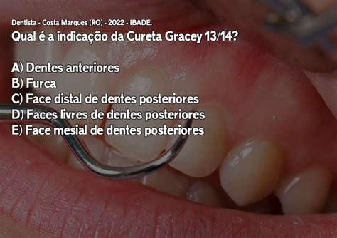 Indicações das Curetas Gracey e McCall Periodontia Resumo Concurso