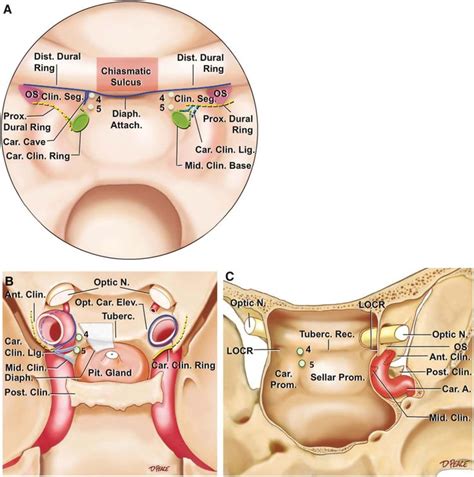 Sphenoid Sinus Anatomy With Images Sinusitis Anatomy Brain Anatomy