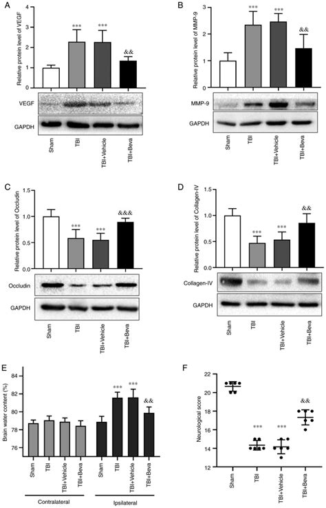 Vegf Regulates The Blood‑brain Barrier Through Mmp‑9 In A Rat Model Of