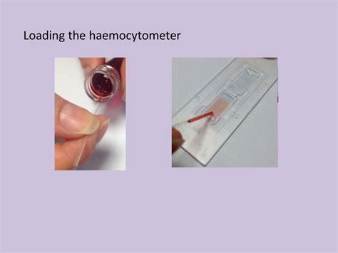 Counting Cells Using A Haemocytometer Ppt Download