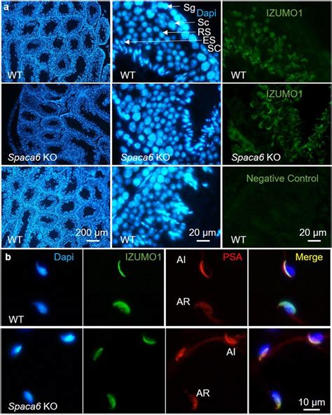 Normal Testis And Epididymal Sperm Localization And Relocation After