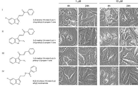 Compounds I And II Induce Extreme Cytoplasmic Vacuolization In U251