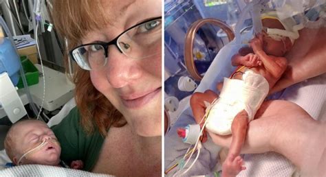 Parents Of Premature Baby Born 12 Weeks Early Happy He S Home