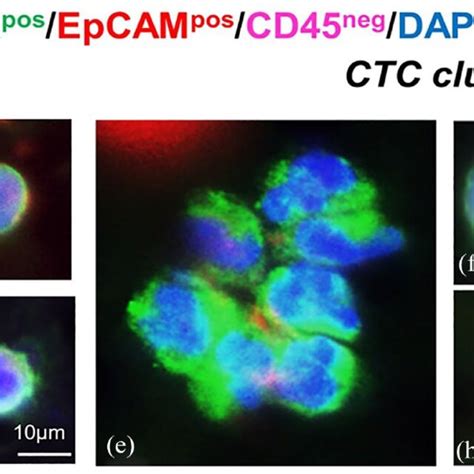 A Circulating Tumor Cells Ctcs And Ctc Clusters Found In Nsclc