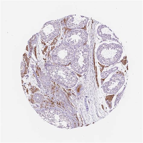 Tissue Expression Of Apoe Staining In Testis The Human Protein Atlas