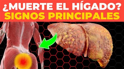 DAÑO HEPÁTICO 9 señales EXTRAÑAS a las que debes prestar atención