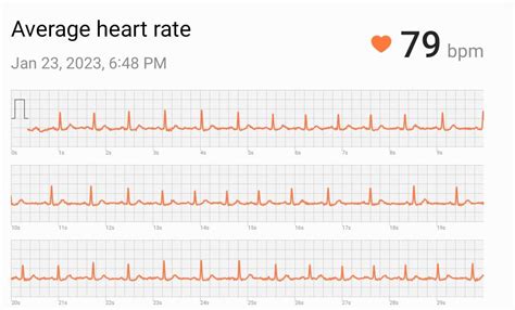 Ekg results normal ? : r/GalaxyWatch