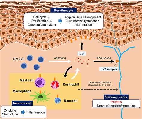 Atopic Dermatitis Pathway