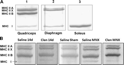 Electrophoretic Separation Of The Various Myosin Heavy Chain Protein