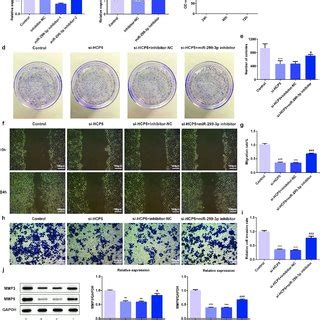 LncRNA HCP5 Silencing Inhibits The Migratory And Invasive Abilities Of