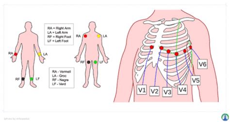 ekg interpretation overview  practice questions