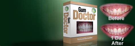 Gum Disease Gum Disease Treatment Gum Doctor