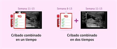 La Translucencia Nucal Y El Cribado Combinado Del Primer Trimestre