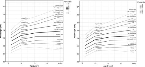 Understanding Myopia Risk Factors