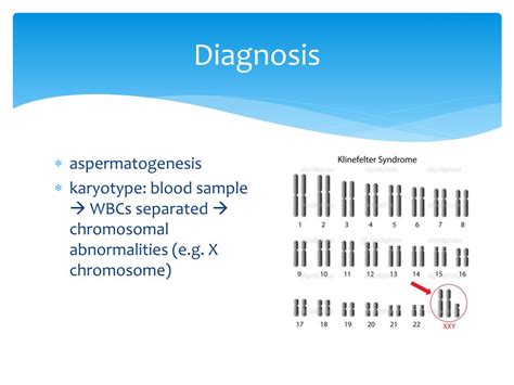 Ppt Klinefelter Syndrome Powerpoint Presentation Free Download Id 6730667