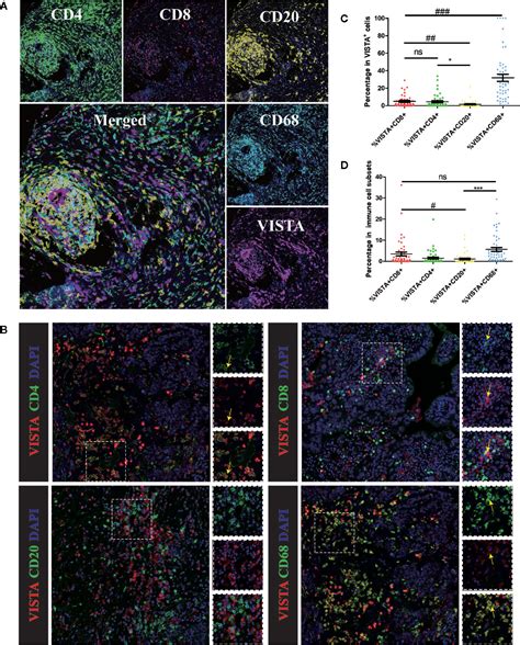 Frontiers The Expression Pattern And Clinical Significance Of The