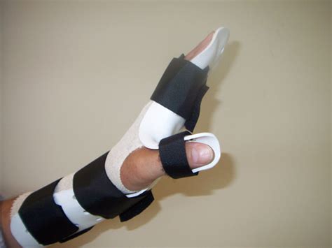 Volar Hand Splint