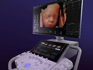 Voluson Signature For Women S Health Ultrasound Ge Healthcare