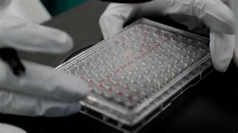 Nyc Health Department Offers New Recommendations On Safe Sex During Covid Abc News