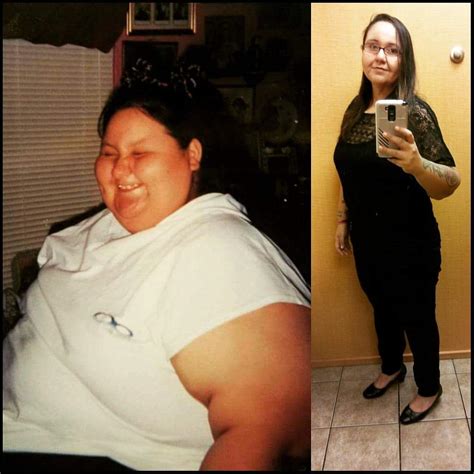 F3854 395lbs165lbs230lbs 230 Lbs Gone Without Surgery R