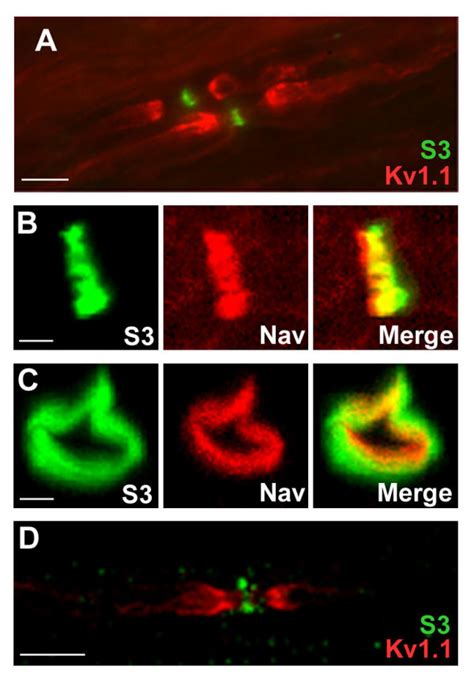 Localization Of S In Nodal Regions Of The Pns A C Sections Through