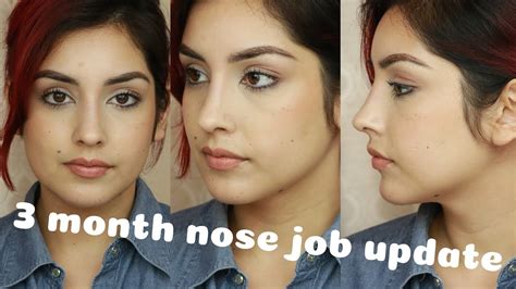 pay   nose job job retro