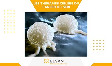 Cancer Du Foie Symptomes Diagnostic Traitements Et Espérance De Vie